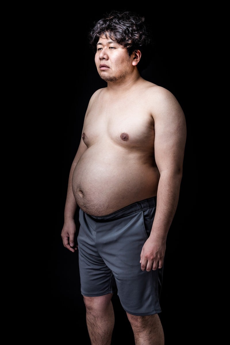 「たった2ヶ月で、このカラダ（肥満）」の写真［モデル：あまのじゃく］