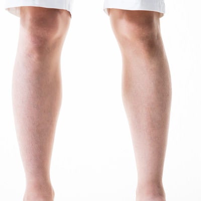 男性の足のすね毛（6mm）の写真