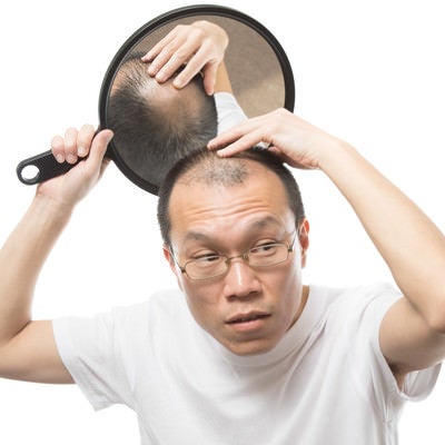 頭頂部の様子をヘアチェックする薄毛男性の写真
