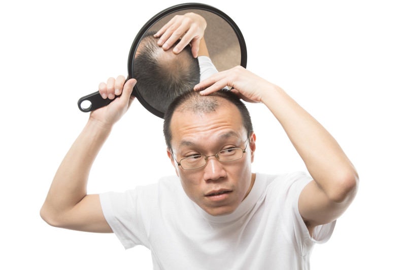 頭頂部の様子をヘアチェックする薄毛男性の写真