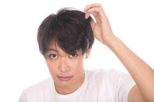 髪の毛の量を気にする若い男性の写真