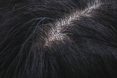 ふさふさの頭髪と頭皮（ヘアチェック）の写真