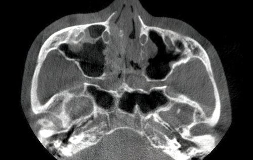 頭部のMRI画像の写真