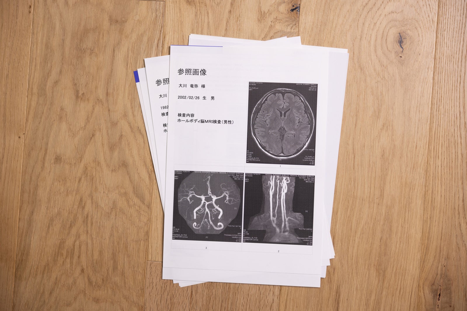 「大川竜弥のホールボディ脳MRI検査画像（男性）」の写真［モデル：大川竜弥］