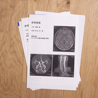 大川竜弥のホールボディ脳MRI検査画像（男性）の写真