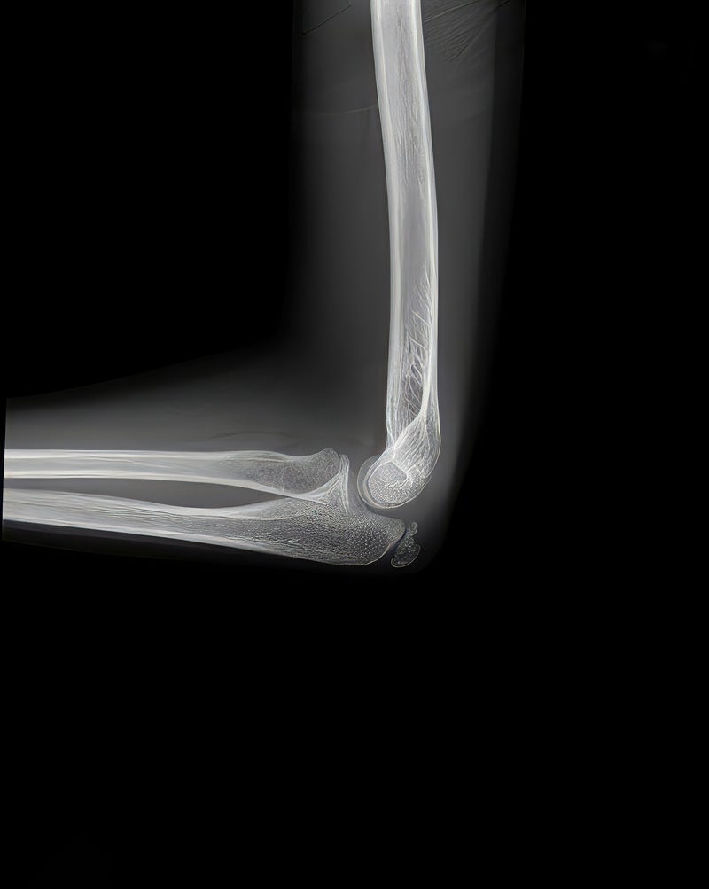 「肘関節のレントゲン」の写真［モデル：あんんじゅ］