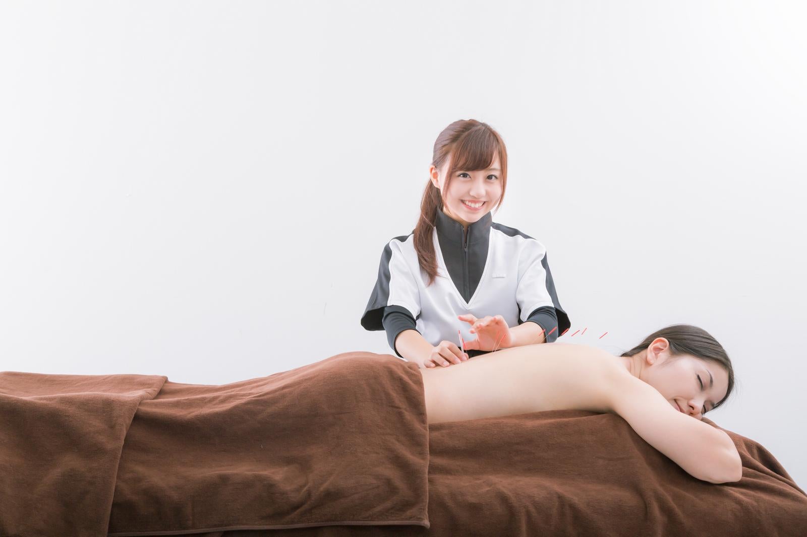 「横になった女性の背中に鍼をさす鍼灸師」の写真［モデル：河村友歌 モデルリリース］